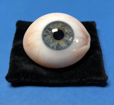 结膜囊成型术咨询